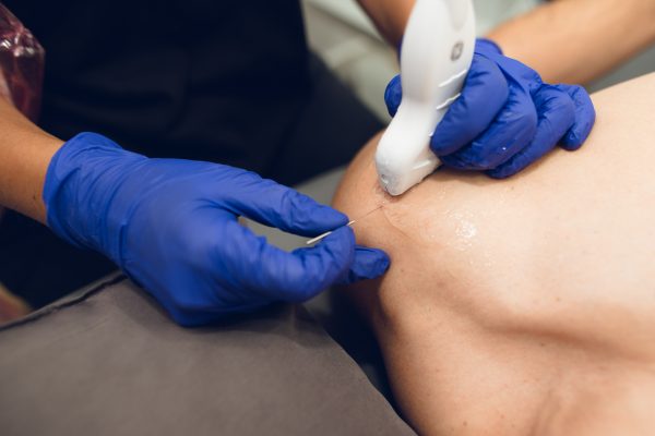 terapia miofascial Madrid
